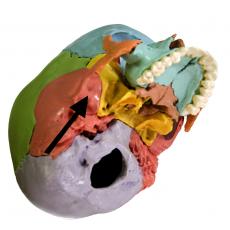 fosse mandibulaire de l'os temporal