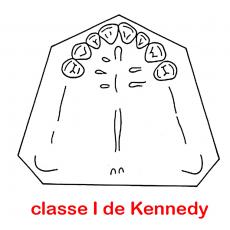 classe de Kennedy  I
