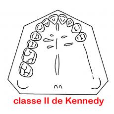 classe de Kennedy  II