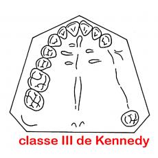 classe de Kennedy III