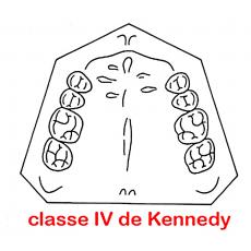 classe de Kennedy IV